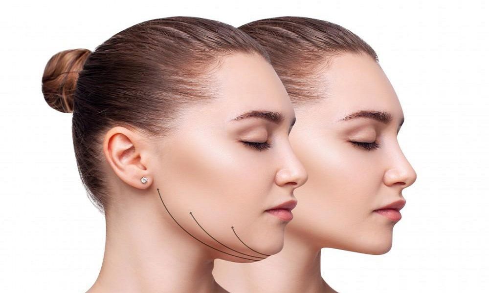 جراحی ساکشن غبغب