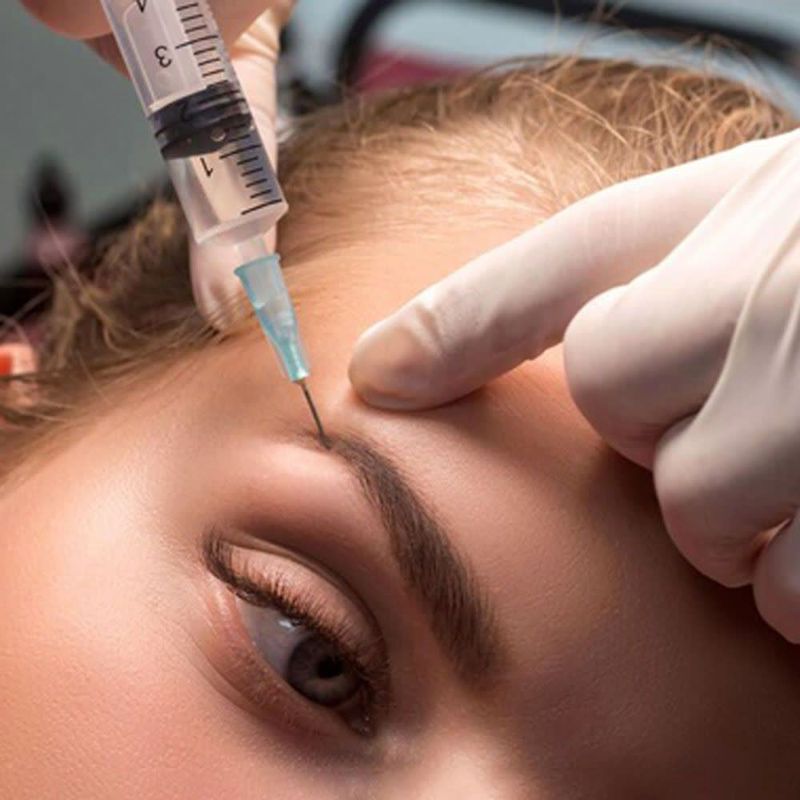 مزوتراپی ابرو 